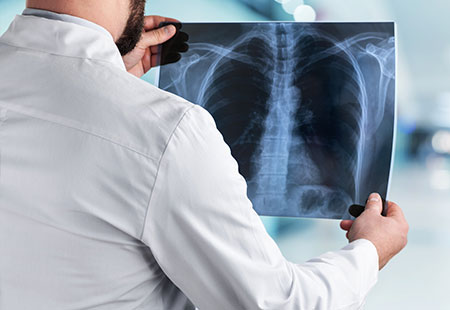 Header cancer pano mobile