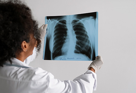 Header Asbestos Mesothelioma pano mobile